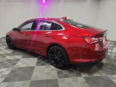 2025 Chevrolet Malibu 1LT
